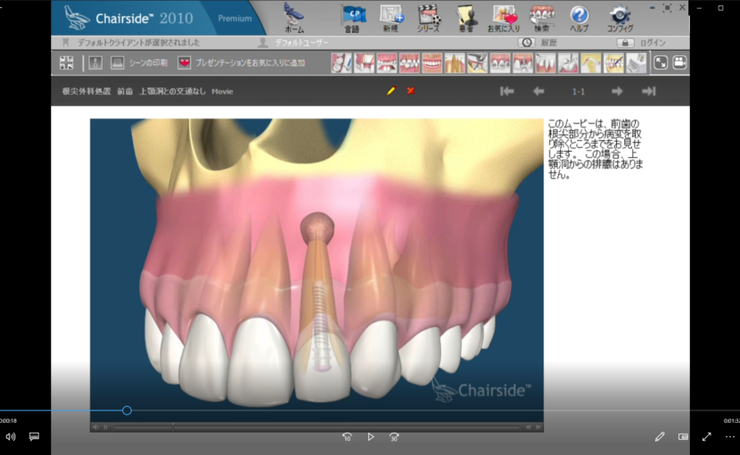 11歯内療法　C外科的歯内療法　根尖外科処置　前歯　上顎洞との交通なし